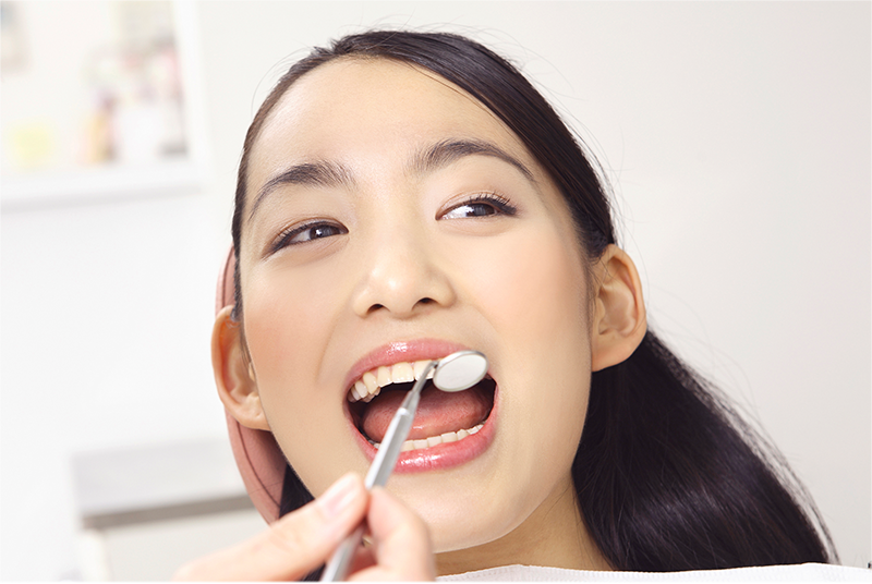 銀歯が気になる方へ セラミック治療